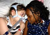 cystic fibrosis